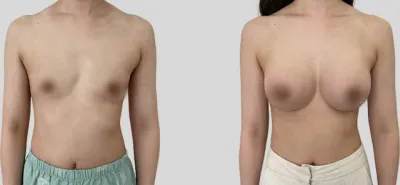 Before & After
