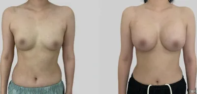 Before & After