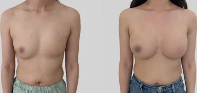 Before & After