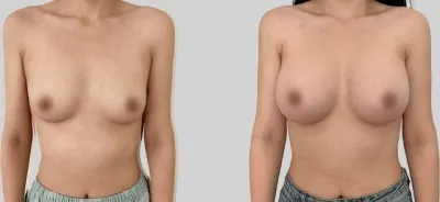 Before & After