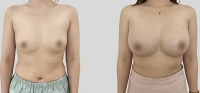 Before & After