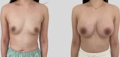 Before & After