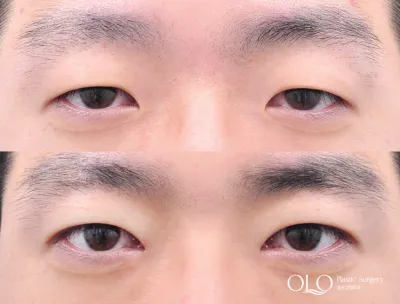 Before & After