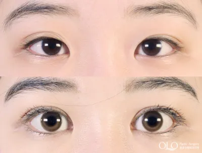 Before & After