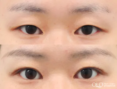 Before & After