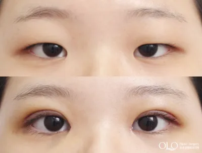Before & After