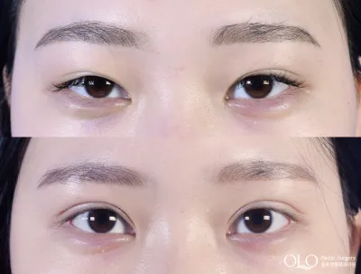 Before & After