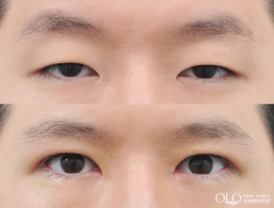 Before & After