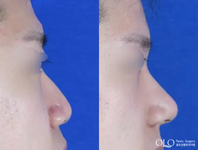 Before & After