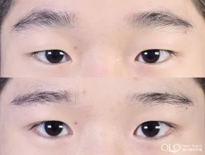 Before & After