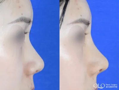 Before & After