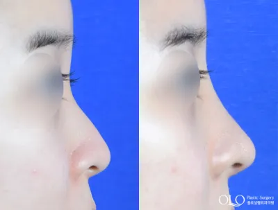 Before & After