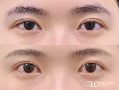 Before & After