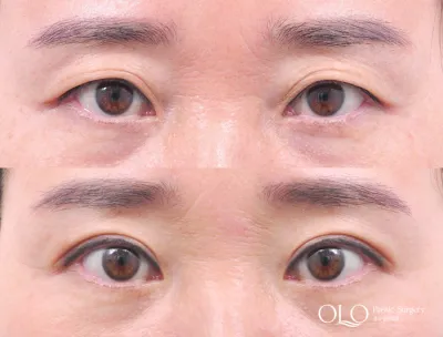 Before & After