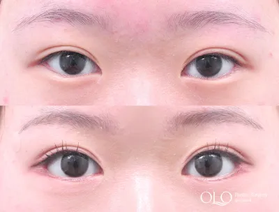 Before & After