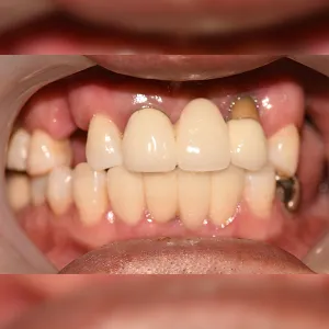 Before