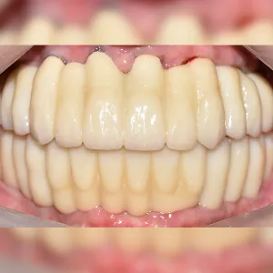 After