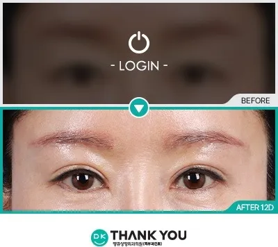 Before & After