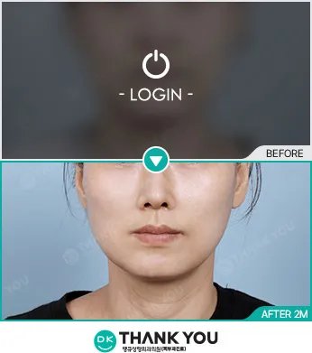 Before & After