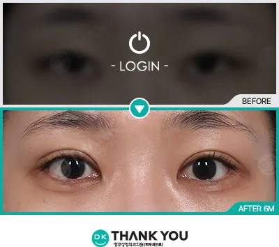 Before & After