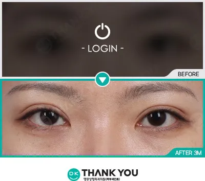 Before & After
