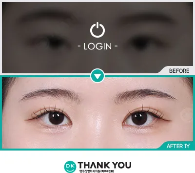 Before & After
