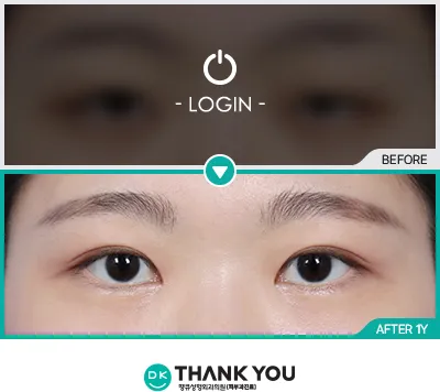 Before & After