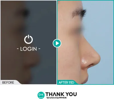 Before & After