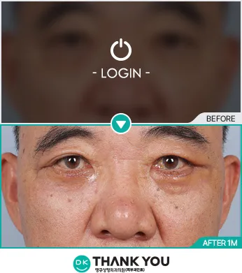 Before & After