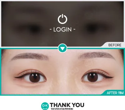 Before & After