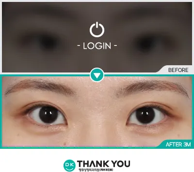 Before & After