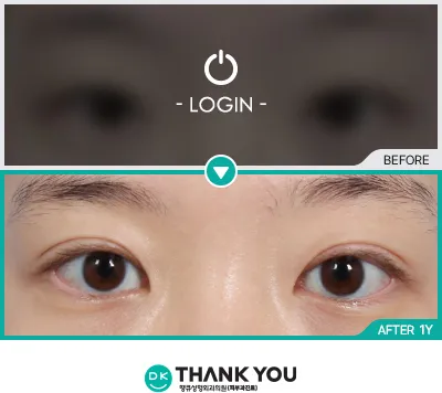 Before & After