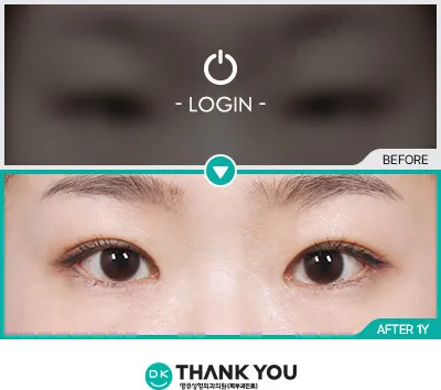 Before & After
