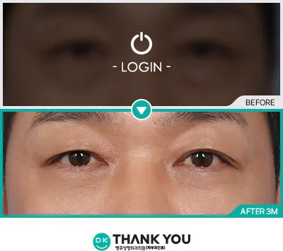 Before & After