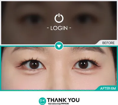 Before & After