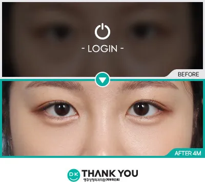 Before & After
