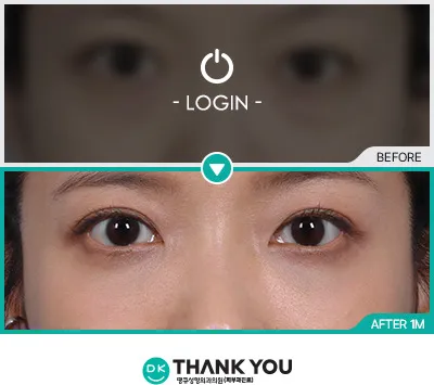 Before & After