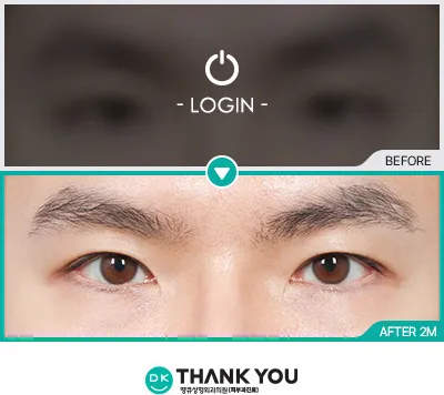 Before & After