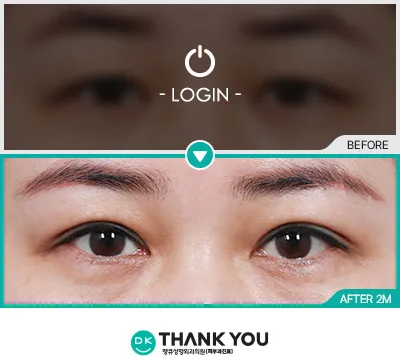 Before & After