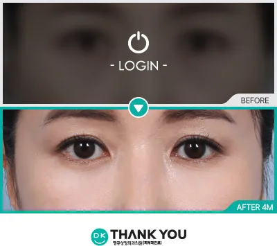 Before & After
