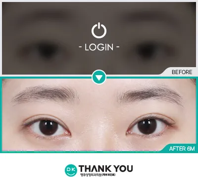 Before & After