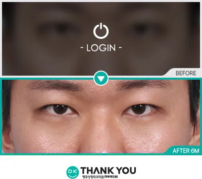 Before & After