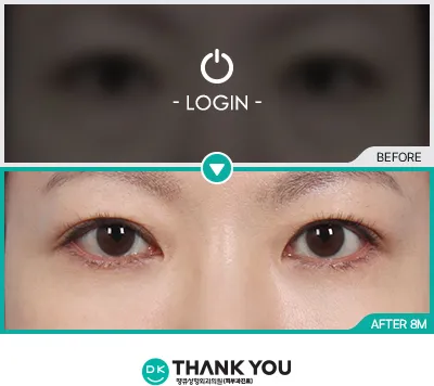 Before & After