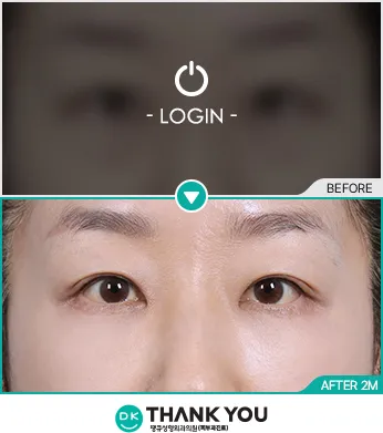 Before & After