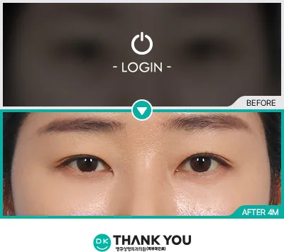 Before & After
