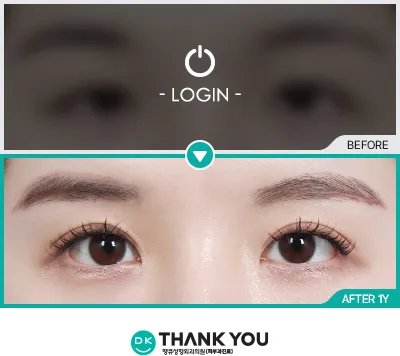 Before & After