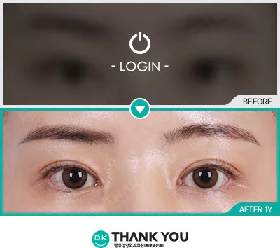 Before & After