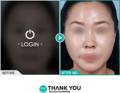 Before & After