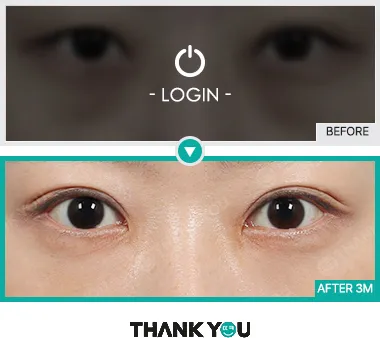 Before & After