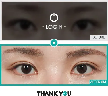 Before & After